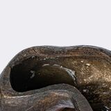 A foot that is too large - image 2